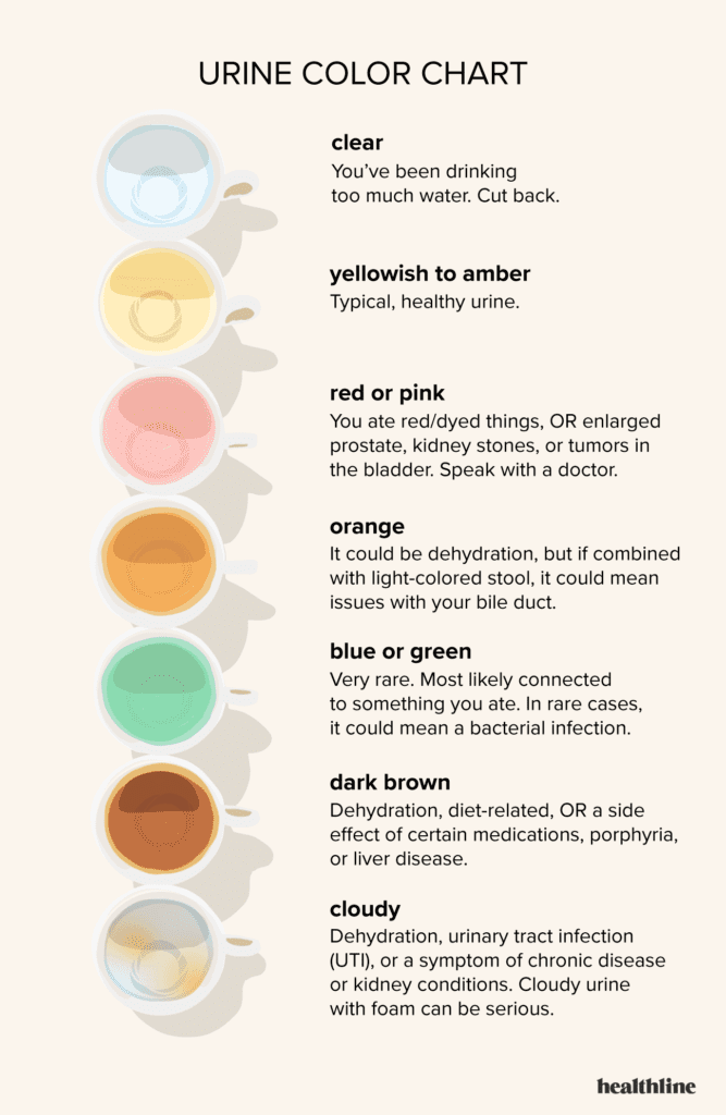 What Does The Color Of Your Urine Mean?
